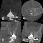 CBCT Scan Film