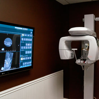 CBCT Technology