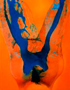 Root Canal X-Ray