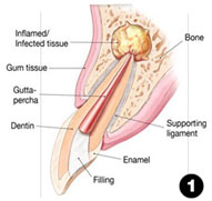 surgery procedure 1